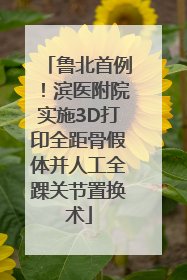 鲁北首例！滨医附院实施3D打印全距骨假体并人工全踝关节置换术